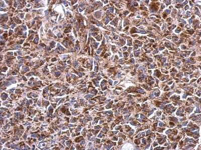 Immunohistochemistry-Paraffin: SHMT2 Antibody [NBP2-20354] - Immunohistochemical analysis of paraffin-embedded HeLa xenograft, using antibody at 1:500 dilution.