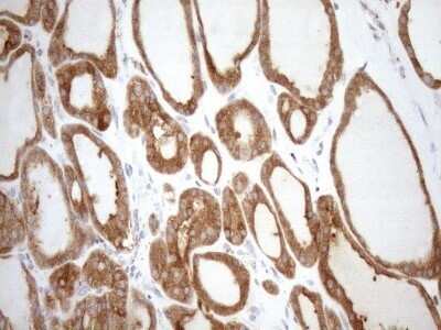 Immunohistochemistry: SHMT2 Antibody (OTI3E9) - Azide and BSA Free [NBP2-74171] - Analysis of Human thyroid tissue. (Heat-induced epitope retrieval by 1mM EDTA in 10mM Tris buffer (pH8.5) at 120C for 3 min)