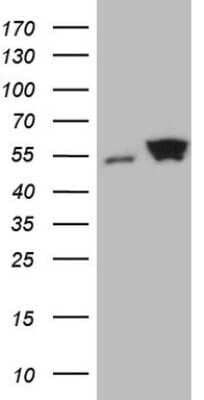 Western Blot: SHMT2 Antibody (OTI3E9) - Azide and BSA Free [NBP2-74171] - Analysis of HEK293T cells were transfected with the pCMV6-ENTRY control (Left lane) or pCMV6-ENTRY SHMT2.