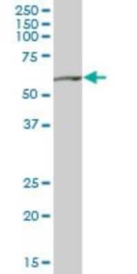 Western Blot: SHMT2 Antibody [H00006472-B01P] - Analysis of SHMT2 expression in human spleen.