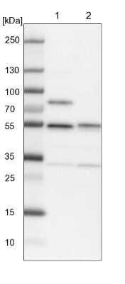 Western Blot: SHMT2 Antibody [NBP1-80754] - Lane 1: NIH-3T3 cell lysate (Mouse embryonic fibroblast cells). Lane 2: NBT-II cell lysate (Rat Wistar bladder tumor cells).