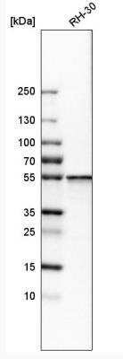 Western Blot: SHMT2 Antibody [NBP1-80754] - Analysis in human cell line RH-30.