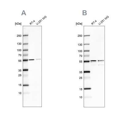 <b>Independent Antibodies Validation. </b>Western Blot: SHMT2 Antibody [NBP1-80754] - Analysis using Anti-SHMT2 antibody NBP1-80754 (A) shows similar pattern to independent antibody NBP1-80755 (B).