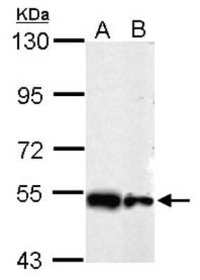 Western Blot: SHMT2 Antibody [NBP2-20354] - Sample (whole cell lysate) A: 293T 10ug, B: HeLa 10ug, 7. 5% SDS PAGE gel, diluted at 1:10000.