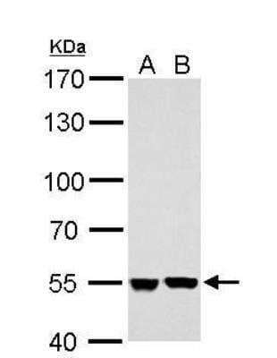 Western Blot: SHMT2 Antibody [NBP2-20354] - A. 30 ug A431 whole cell lysate/extract B. 30 ug HepG2 whole cell ysate/extract 7.5 % SDS-PAGE SHMT2 antibody dilution: 1:5000