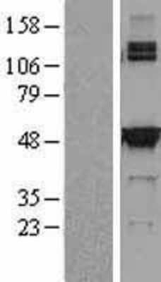 Western Blot: SHMT2 Overexpression Lysate (Adult Normal) [NBL1-15948] Left-Empty vector transfected control cell lysate (HEK293 cell lysate); Right -Over-expression Lysate for SHMT2.