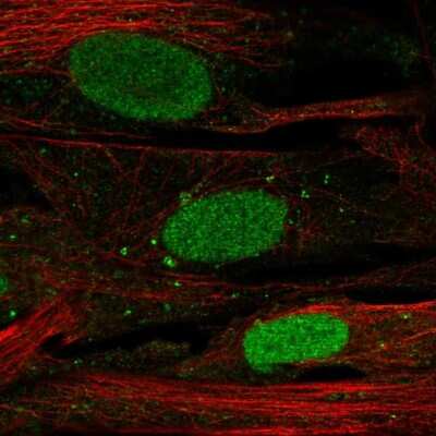 Immunocytochemistry/Immunofluorescence: SHOX Antibody [NBP2-55181] - Staining of human cell line BJ shows localization to nucleoplasm & vesicles.