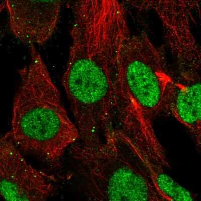 Immunocytochemistry/Immunofluorescence: SHOX Antibody [NBP2-56369] - Staining of human cell line BJ shows localization to nucleoplasm & vesicles.