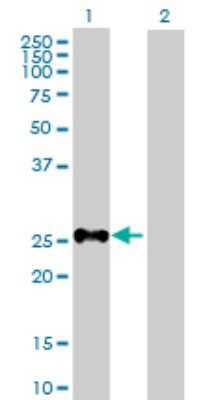 Western Blot: SHOX Antibody [H00006473-B01P] - Analysis of SHOX expression in transfected 293T cell line by SHOX polyclonal antibody.  Lane 1: SHOX transfected lysate(24.75 KDa). Lane 2: Non-transfected lysate.