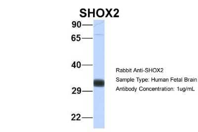 Western Blot SHOX2 Antibody - BSA Free