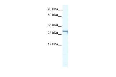 Western Blot: SHOX2 Antibody [NBP2-86806] - WB Suggested Anti-SHOX2 Antibody Titration: 0.2-1 ug/ml. ELISA Titer: 1:62500. Positive Control: Jurkat cell lysate