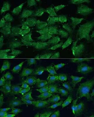 <b>Genetic Strategies Validation. </b>Immunocytochemistry/Immunofluorescence: SHP-2/PTPN11 Antibody [NBP3-03486] - Analysis of C6 cells using SHP-2/PTPN11 antibody at dilution of 1:100. Blue: DAPI for nuclear staining.