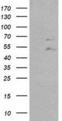 Western Blot: SHP-2/PTPN11 Antibody (OTI3F2) - Azide and BSA Free [NBP2-74173] - HEK293T cells were transfected with the pCMV6-ENTRY control (Left lane) or pCMV6-ENTRY PTPN11/SHP2 (Right lane) cDNA for 48 hrs and lysed. Equivalent amounts of cell lysates (5 ug per lane) were separated by SDS-PAGE and immunoblotted with anti-PTPN11/SHP