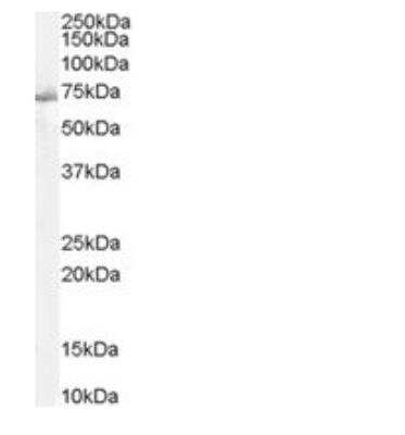 Western Blot: SHP-2/PTPN11 Antibody [NB100-806] - Human Muscle lysate (RIPA buffer, 35 ug total protein per lane). Antibody at 2 ug/mL. Detected by chemiluminescence.