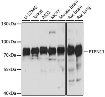 Western Blot: SHP-2/PTPN11 Antibody [NBP3-03486] - Analysis of extracts of various cell lines, using SHP-2/PTPN11 antibody at 1:1000 dilution. Secondary antibody: HRP Goat Anti-Rabbit IgG (H+L) at 1:10000 dilution. Lysates/proteins: 25ug per lane. Blocking buffer: 3% nonfat dry milk in TBST.