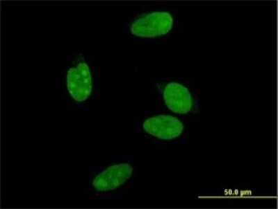 Immunocytochemistry/Immunofluorescence: SHP/NR0B2/Nuclear Receptor SHP Antibody (1A11) [H00008431-M01] - Analysis of monoclonal antibody to NR0B2 on HeLa cell . Antibody concentration 10 ug/ml.