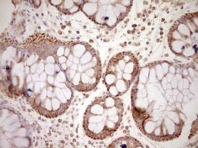 Immunohistochemistry: SHP/NR0B2/Nuclear Receptor SHP Antibody (7B5) [NBP2-46522] - Analysis of Human colon tissue (Heat-induced epitope retrieval by Tris-EDTA, pH8.0)