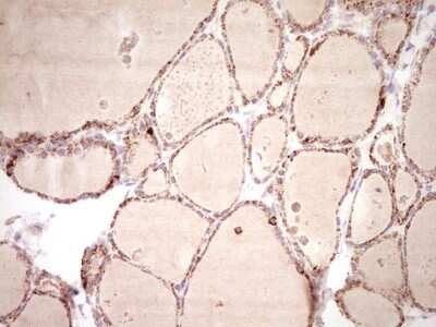 Immunohistochemistry: SHP/NR0B2/Nuclear Receptor SHP Antibody (7B5) [NBP2-46522] - Analysis of Human thyroid tissue. (Heat-induced epitope retrieval by Tris-EDTA, pH8.0)