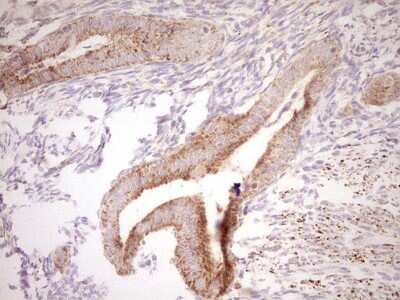 Immunohistochemistry: SHP/NR0B2/Nuclear Receptor SHP Antibody (7B5) [NBP2-46522] - Analysis of Human endometrium tissue. (Heat-induced epitope retrieval by Tris-EDTA, pH8.0)