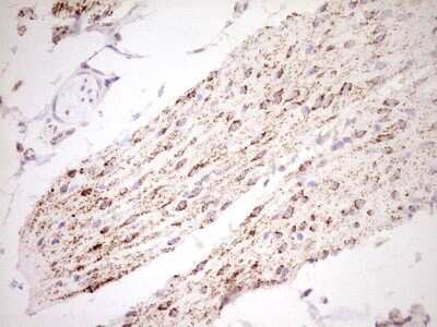 Immunohistochemistry: SHP/NR0B2/Nuclear Receptor SHP Antibody (7B5) [NBP2-46522] - Analysis of Human bladder tissue. (Heat-induced epitope retrieval by Tris-EDTA, pH8.0)