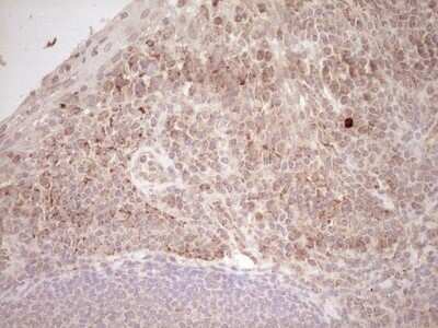 Immunohistochemistry: SHP/NR0B2/Nuclear Receptor SHP Antibody (7B5) [NBP2-46522] - Analysis of Human tonsil tissue. (Heat-induced epitope retrieval by Tris-EDTA, pH8.0)