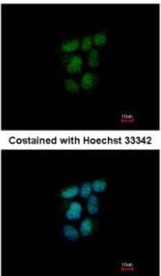 Immunocytochemistry/Immunofluorescence: SHP/NR0B2/Nuclear Receptor SHP Antibody [NBP1-33597] - Paraformaldehyde-fixed A431, using antibody at 1:500 dilution.