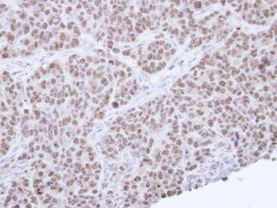 Immunohistochemistry-Paraffin: SHP/NR0B2/Nuclear Receptor SHP Antibody [NBP1-33597] - SW480 Xenograft, using NR0B2(GTX113874) antibody at 1:100 dilution. Antigen Retrieval: Citrate buffer, pH 6.0, 15 min