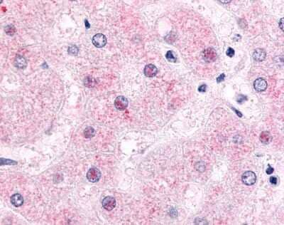 Immunohistochemistry-Paraffin: SHP/NR0B2/Nuclear Receptor SHP Antibody [NLS5411] - Analysis of anti-NR0B2 antibody with human liver, hepatocytes.