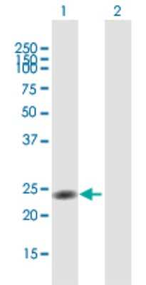 Western Blot: SHP/NR0B2/Nuclear Receptor SHP Antibody [H00008431-B01P] - Analysis of NR0B2 expression in transfected 293T cell line by NR0B2 polyclonal antibody.  Lane 1: NR0B2 transfected lysate(28.27 KDa). Lane 2: Non-transfected lysate.