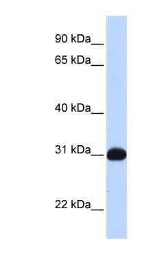 Western Blot: SHP/NR0B2/Nuclear Receptor SHP Antibody [NBP1-52816] - Transfected 293T cell lysate, concentration 0.2-1 ug/ml.