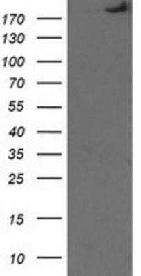 Western Blot: SHPRH Antibody (OTI5G8) - Azide and BSA Free [NBP2-74180] - HEK293T cells were transfected with the pCMV6-ENTRY control (Left lane) or pCMV6-ENTRY SHPRH (Right lane) cDNA for 48 hrs and lysed. Equivalent amounts of cell lysates (5 ug per lane) were separated by SDS-PAGE and immunoblotted with anti-SHPRH.
