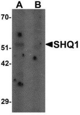 Western Blot SHQ1 Antibody - BSA Free