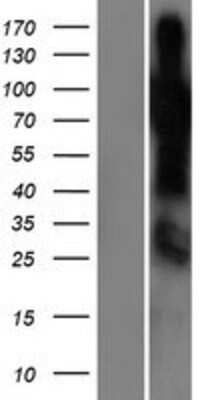 Western Blot SHQ1 Overexpression Lysate