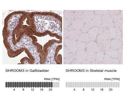 Immunohistochemistry-Paraffin: SHROOM3 Antibody [NBP2-14617] - Analysis in human gallbladder and skeletal muscle tissues using NBP2-14617 antibody. Corresponding SHROOM3 RNA-seq data are presented for the same tissues.