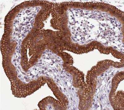 Immunohistochemistry-Paraffin: SHROOM3 Antibody [NBP2-14617] - Staining of human gallbladder shows strong cytoplasmic and membranous positivity in glandular cells.