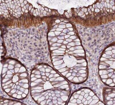 Immunohistochemistry-Paraffin: SHROOM3 Antibody [NBP2-14617] - Staining of human colon shows strong cytoplasmic and membranous postivity in glandular cells.
