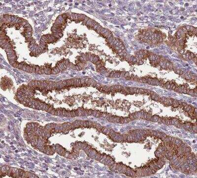 Immunohistochemistry-Paraffin: SHROOM3 Antibody [NBP2-14617] - Staining of human endometrium shows strong membranous and cytoplasmic postivity in glandular cells.