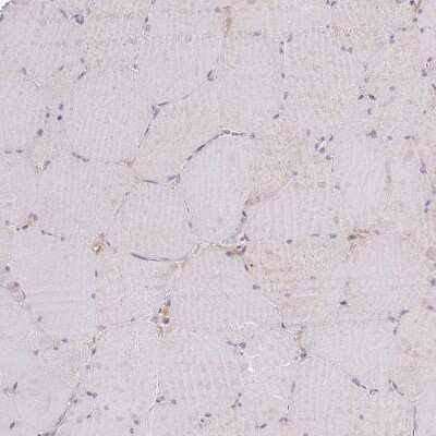 Immunohistochemistry-Paraffin: SHROOM3 Antibody [NBP2-14617] - Staining of human Skeletal muscle shows no positivity in myocytes as expected.