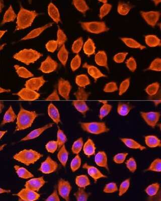 Immunocytochemistry/Immunofluorescence: SIAH1 Antibody [NBP2-93864] - Immunofluorescence analysis of L929 cells using SIAH1 Rabbit pAb (NBP2-93864) at dilution of 1:100. Blue: DAPI for nuclear staining.