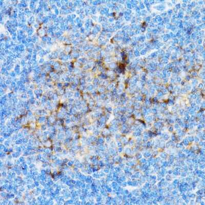 Immunohistochemistry-Paraffin: SIAH1 Antibody [NBP2-93864] - Mouse spleen using SIAH1 antibody at dilution of 1:100 (40x lens).Perform microwave antigen retrieval with 10 mM PBS buffer pH 7.2 before commencing with IHC staining protocol.