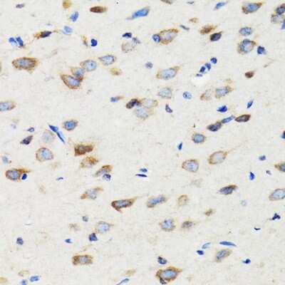Immunohistochemistry-Paraffin: SIAH1 Antibody [NBP2-93864] -  Rat brain using SIAH1 antibody at dilution of 1:100 (40x lens).Perform microwave antigen retrieval with 10 mM PBS buffer pH 7.2 before commencing with IHC staining protocol.
