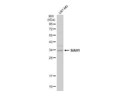 Western Blot: SIAH1 Antibody [NBP2-20356] - Whole cell extract (30 ug) was separated by 12% SDS-PAGE, and the membrane was blotted with SIAH1 antibody diluted at 1:1000. The HRP-conjugated anti-rabbit IgG antibody (NBP2-19301) was used to detect the primary antibody.