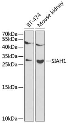 Western Blot: SIAH1 Antibody [NBP2-94122] - Analysis of extracts of various cell lines, using SIAH1 at 1:1000 dilution. Secondary antibody: HRP Goat Anti-Rabbit IgG (H+L) at 1:10000 dilution. Lysates/proteins: 25ug per lane. Blocking buffer: 3% nonfat dry milk in TBST.