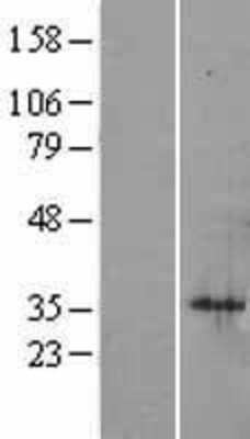 Western Blot: SIAH1 Overexpression Lysate (Adult Normal) [NBL1-15954] Left-Empty vector transfected control cell lysate (HEK293 cell lysate); Right -Over-expression Lysate for SIAH1.
