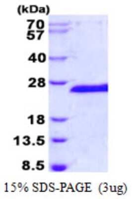 SDS-PAGE Recombinant Human SIAH1 His Protein