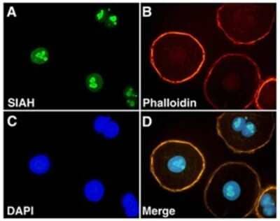 Immunocytochemistry/Immunofluorescence: SIAH2 Antibody (24E6H3) [NB110-88113] - Staining of SIAH in ovarian carcinoma (OVCR3) cells using NB110-88113.