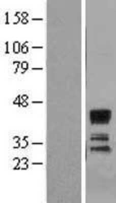 Western Blot ST3 beta-Gal alpha-2,3-Sialyltransferase 1/ST3GAL1/SIAT4A Overexpression Lysate