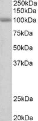 Western Blot SIDT1 Antibody