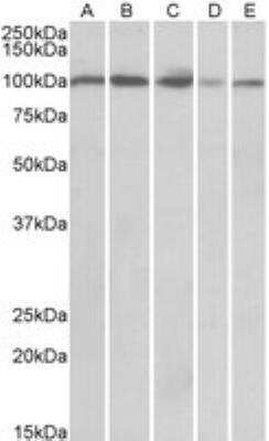Western Blot SIDT1 Antibody