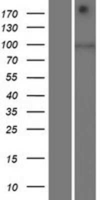 Western Blot: SIDT1 Overexpression Lysate (Adult Normal) [NBP2-06941] Left-Empty vector transfected control cell lysate (HEK293 cell lysate); Right -Over-expression Lysate for SIDT1.